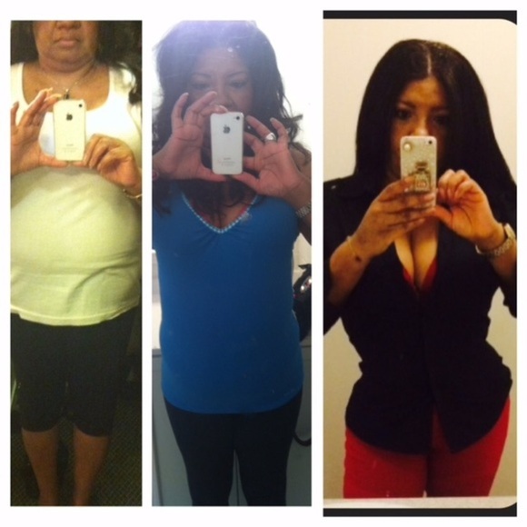 How I lost 130lbs, sculpted my body w/ no surgery - Picture 6 of 10